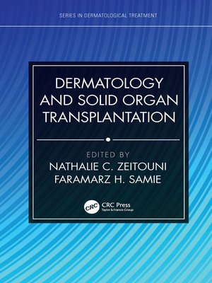 cover image of Dermatology and Solid Organ Transplantation